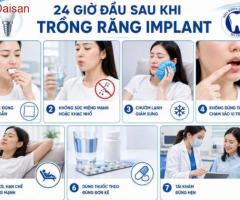 Những điều cần lưu ý sau khi trồng răng implant