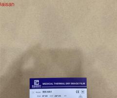 Phim y tế X-quang - 2